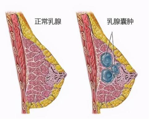 孕妇几个月开始有奶水，深度解析孕期的乳腺变化