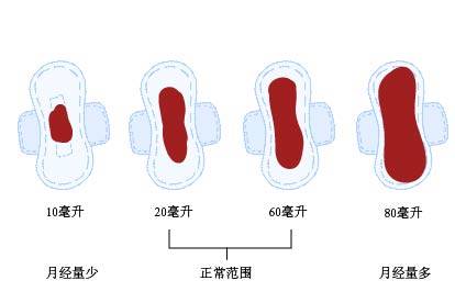 关于女性四个月未月经的探讨，原因、影响与对策