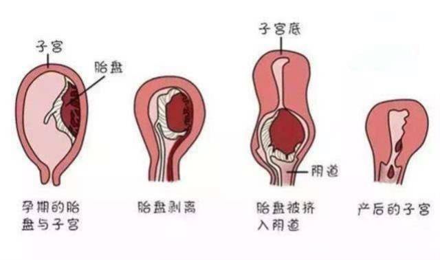 产后两个月偶尔出血，原因、关注与处理方法