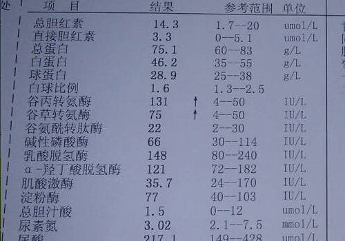 澳门知识专家解析，2个月的宝宝转氨酶高的原因与应对策略